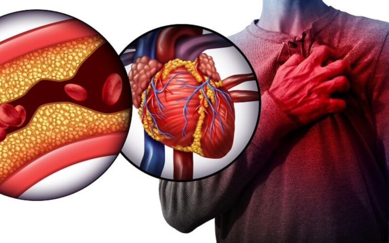 ਦਿਲ ‘ਚ ਖੂਨ ਦਾ ਗਤਲਾ: ਕਾਰਨ, ਲੱਛਣ ਅਤੇ ਰੋਕਥਾਮ ਦੇ ਉਪਾਅ