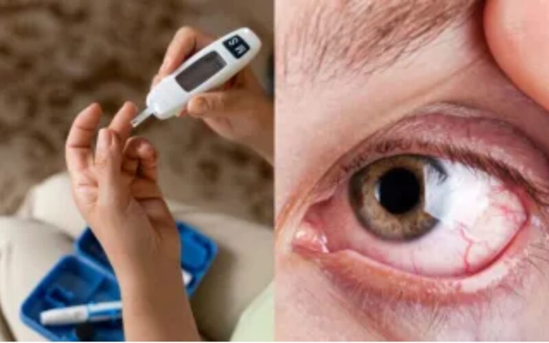 ਬਹੁਤ ਜ਼ਿਆਦਾ ਮਿਠਾਈਆਂ ਖਾਣਾ ਤੁਹਾਡੀਆਂ ਅੱਖਾਂ ਲਈ ਹੋ ਸਕਦਾ ਖ਼ਤਰਨਾਕ: ਡਾਇਬੀਟਿਕ ਰੈਟੀਨੋਪੈਥੀ ਵਧਾ ਸਕਦੀ ਹੈ ਜੋਖਮ