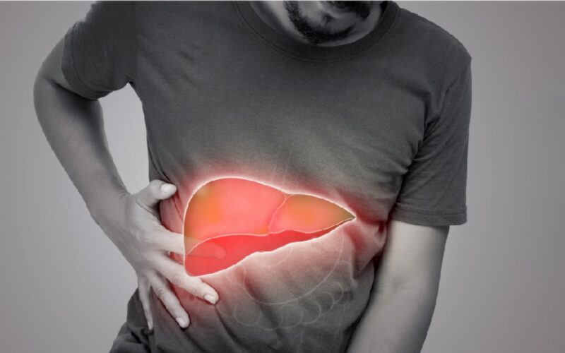 ਜਿਗਰ ਦੀ ਸੋਜਸ਼ ਦੇ ਕੀ ਹਨ ਲੱਛਣ ਤੇ ਇਹ ਕਿੰਨਾ ਖਤਰਨਾਕ ਹੈ?