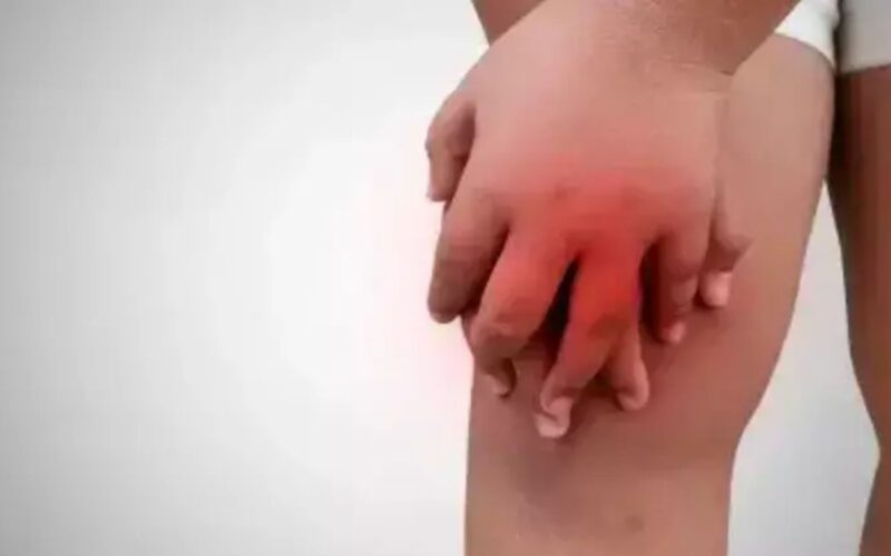 ਗਠੀਆ: ਜੋੜਾਂ ਦੀ ਸੋਜ ਤੇ ਦਰਦ ਨਾਲ ਜੁੜੀ ਆਮ ਪਰ ਗੰਭੀਰ ਬਿਮਾਰੀ