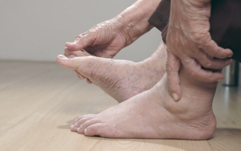 ਪੈਰਾਂ ‘ਚ ਵਾਰ-ਵਾਰ ਸੋਜ ਹੋਣਾ ਹੋ ਸਕਦਾ ਕਿਸੇ ਗੰਭੀਰ ਬਿਮਾਰੀ ਦਾ ਸੰਕੇਤ, ਜਾਣੋ ਕਾਰਨ ਤੇ ਰੋਕਥਾਮ ਦੇ ਉਪਾਅ