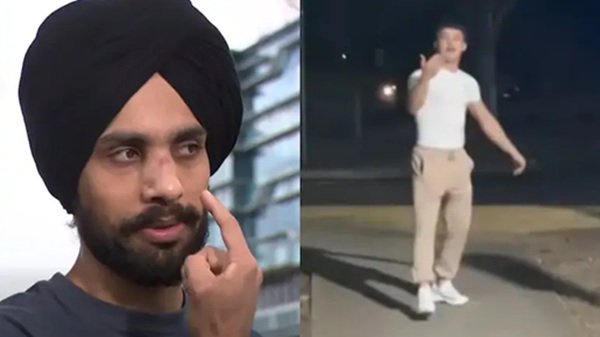Australia ’ਚ ਸਿੱਖ ਨੌਜਵਾਨ ’ਤੇ ਨਸਲੀ ਹਮਲਾ; ਹਮਲੇ ’ਚ ਹਰਮਨਪ੍ਰੀਤ ਸਿੰਘ ਦੀ ਨੱਕ ’ਤੇ ਵੱਜੀ ਸੱਟ